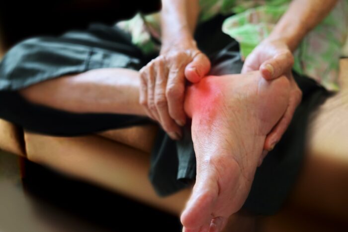 Gout